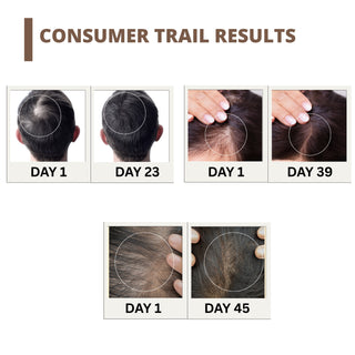 Buy 2 & Get 3 Perenne Hair Strengthening Serum | Hair Fall Control, Hair Growth & Regrowth | Redensyl, Bicapil & Anagain | Sulphate & Paraben Free | All Hair Types