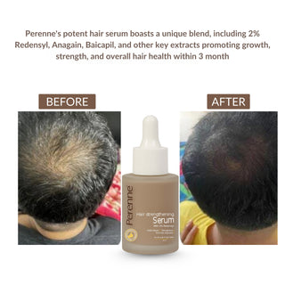 Buy 2 & Get 3 Perenne Hair Strengthening Serum | Hair Fall Control, Hair Growth & Regrowth | Redensyl, Bicapil & Anagain | Sulphate & Paraben Free | All Hair Types