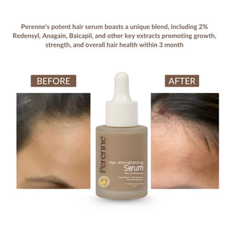 Buy 2 & Get 3 Perenne Hair Strengthening Serum | Hair Fall Control, Hair Growth & Regrowth | Redensyl, Bicapil & Anagain | Sulphate & Paraben Free | All Hair Types