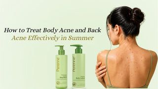 How to Treat Body Acne and Back Acne Effectively in Summer