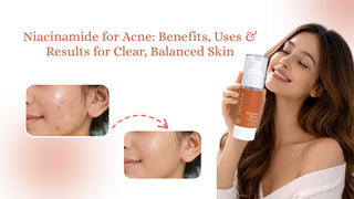 Niacinamide for Acne: Benefits, Uses & Results for Clear, Balanced Skin