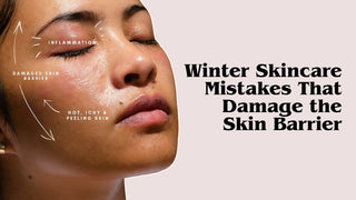 5 Winter Skincare Mistakes That Damage Your Skin Barrier