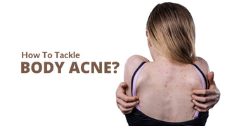 How to Tackle Body Acne?