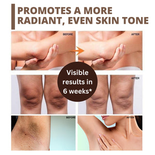 Perenne 7% Glycolic Acid Discoloration Treatment Spray for Skin