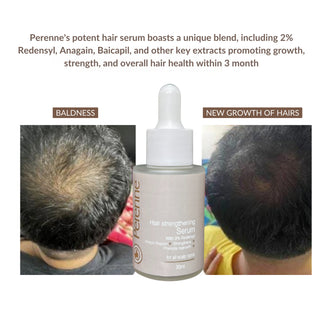 Perenne Hair Strengthening Serum | For Men & Women| With Redensyl, Bicapil & Anagain| Sulphate & Paraben Free| All Hair Types | For Hair Fall Control and Fast Hair Growth