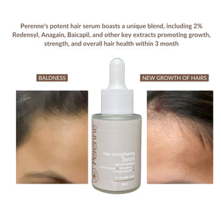 Perenne Hair Strengthening Serum | Hair Fall Control, Hair Growth &  Regrowth | Redensyl, Bicapil & Anagain | Sulphate & Paraben Free | All Hair Types