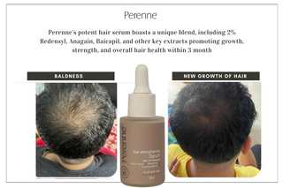 Perenne Hair Strengthening Serum With Redensyl, Bicapil & Anagain For Hair Fall Control and Hair Growth| Suitable For Men & Women